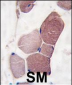UCHL3 Antibody (C-term)